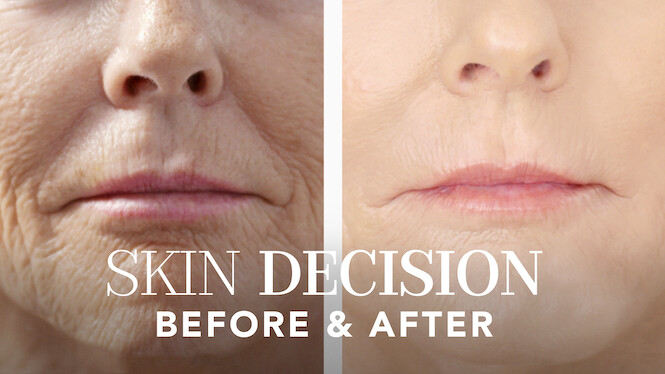 Skin Decision: Before and After